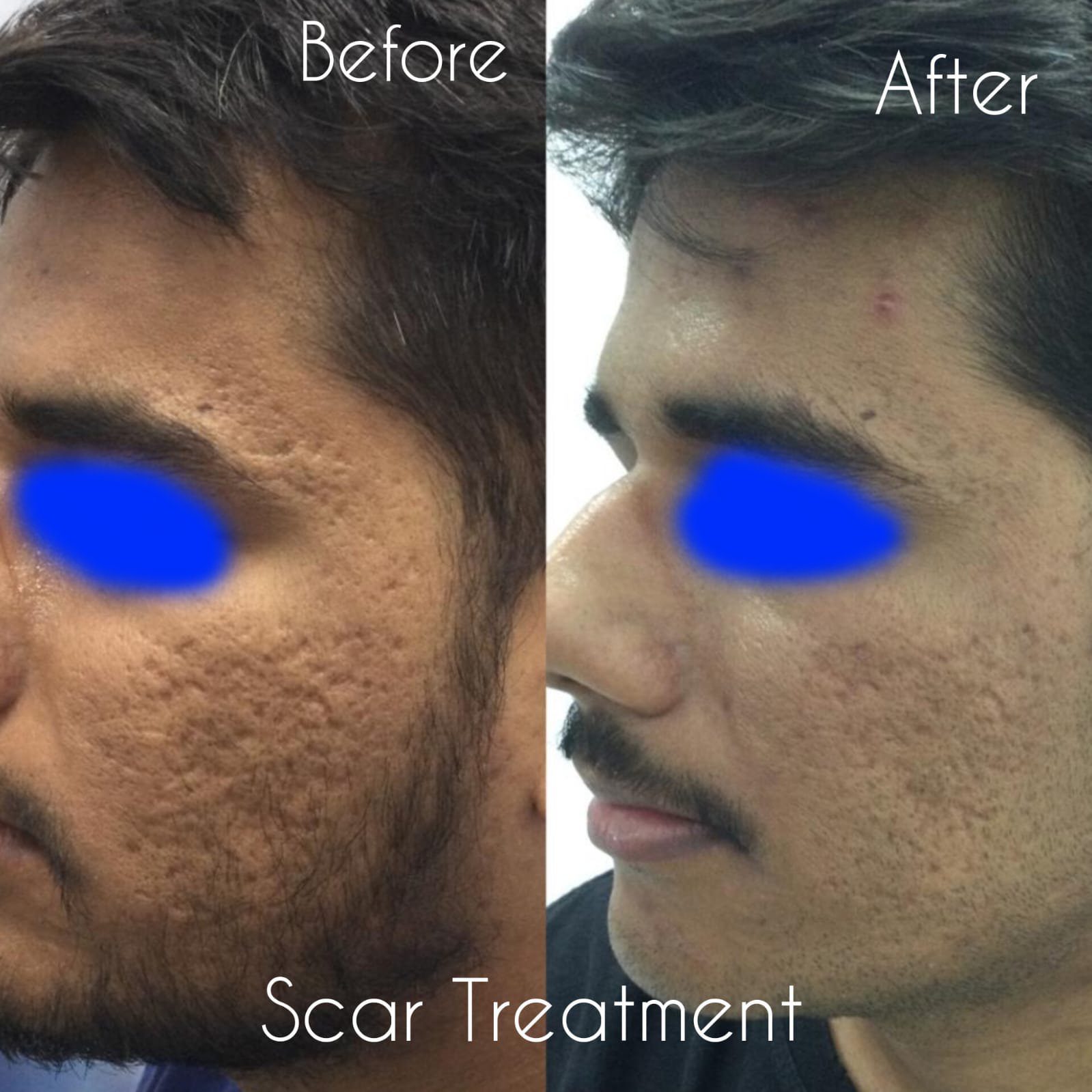 after before