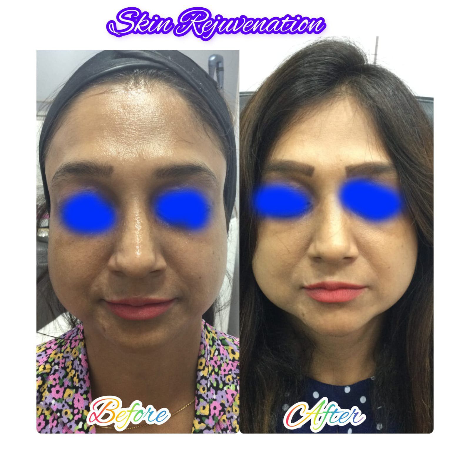 after before