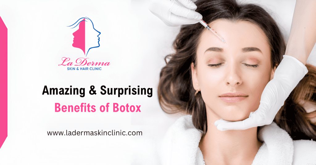 Amazing & Surprising Benefits of Botox - La Derma Skin Clinic