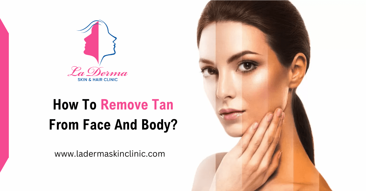 How To Remove Tan From Face And Body? La Derma Skin Clinic