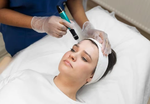 Face Laser Treatment in Kolkata- La Derma Clinic