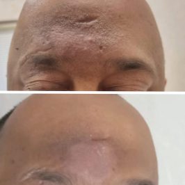 Dark Spots
