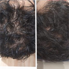 after before