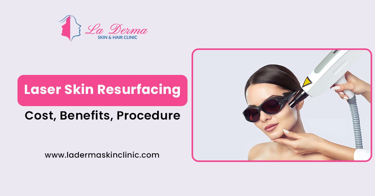 Laser Skin Resurfacing: Cost, Benefits, Procedure