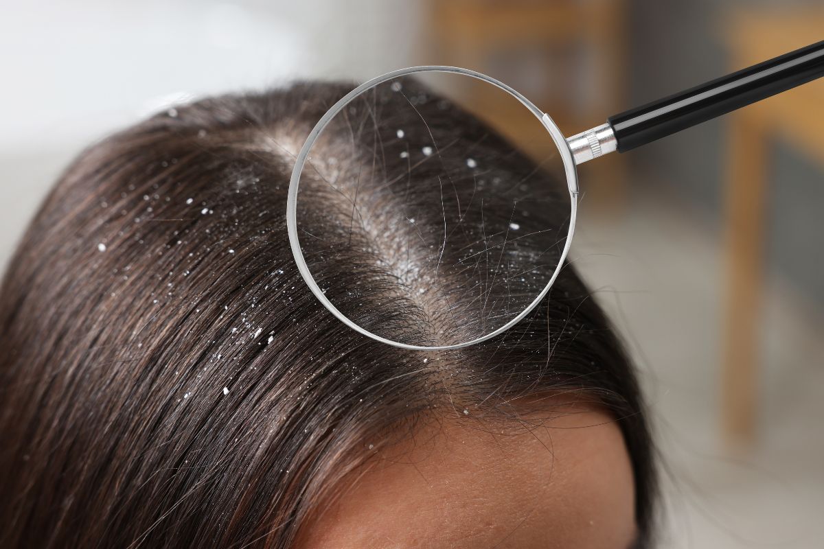 https://ladermaskinclinic.com/wp-content/uploads/2025/10/Scalp-Problems.jpg