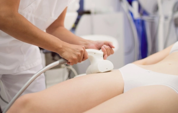 Types of Stretch Marks