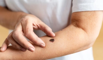 https://ladermaskinclinic.com/wp-content/uploads/2026/03/Arms-Hands.webp
