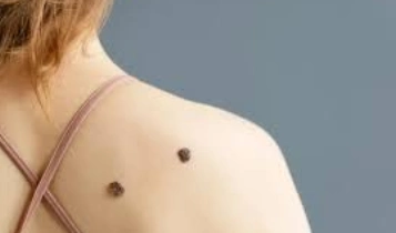 https://ladermaskinclinic.com/wp-content/uploads/2026/03/Back-Shoulders.webp