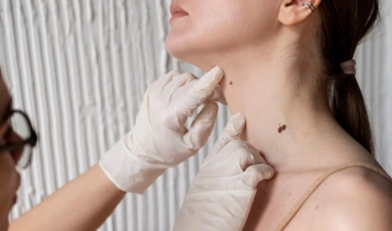 https://ladermaskinclinic.com/wp-content/uploads/2026/03/Neck-Jawline.webp