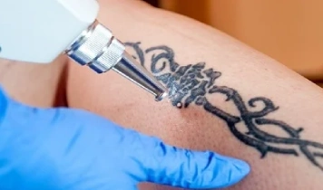 https://ladermaskinclinic.com/wp-content/uploads/2026/03/amateur-tattoos.webp