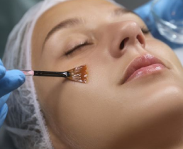 https://ladermaskinclinic.com/wp-content/uploads/2026/04/Chemical-Peels-1.webp