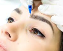 https://ladermaskinclinic.com/wp-content/uploads/2026/04/Classic-Microblading.webp