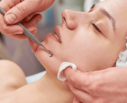 https://ladermaskinclinic.com/wp-content/uploads/2026/04/Comedone-Extraction.webp