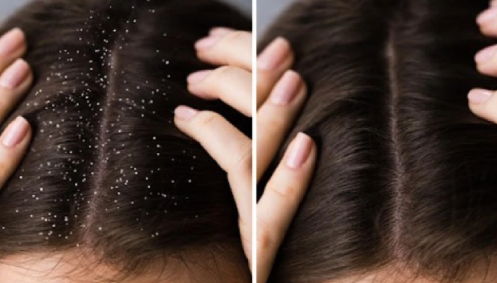 Effective Scalp Solutions for Lasting Health