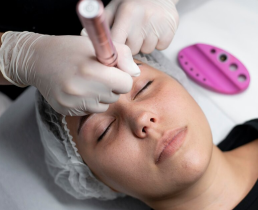 https://ladermaskinclinic.com/wp-content/uploads/2026/04/HydraFacial-for-Acne-Prone-Skin.webp