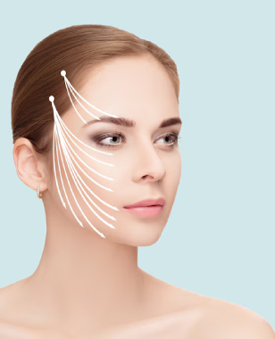 Treatment Thread Lifts