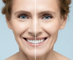 https://ladermaskinclinic.com/wp-content/uploads/2026/05/Cheek-Tightening-Treatment.webp