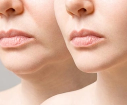 https://ladermaskinclinic.com/wp-content/uploads/2026/05/Jawline-area.webp