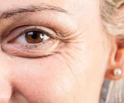https://ladermaskinclinic.com/wp-content/uploads/2026/05/Lines-near-the-eye.webp