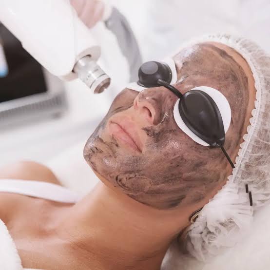 https://ladermaskinclinic.com/wp-content/uploads/2026/07/Carbon-Laser-Peel.jpg