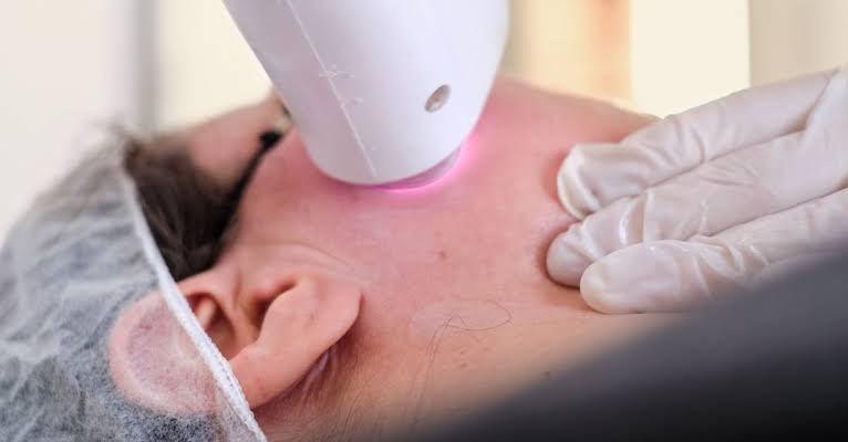 https://ladermaskinclinic.com/wp-content/uploads/2026/07/Laser-Toning.jpg