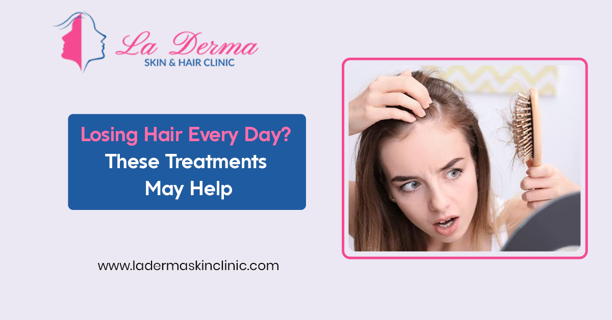Losing Hair Every Day? These Treatments May Help