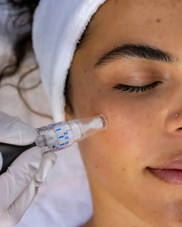 https://ladermaskinclinic.com/wp-content/uploads/2026/07/Microneedling-1.webp