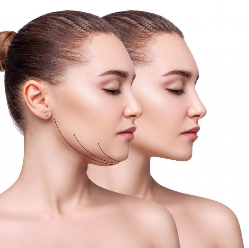  Overview of Double Chin Removal Treatment