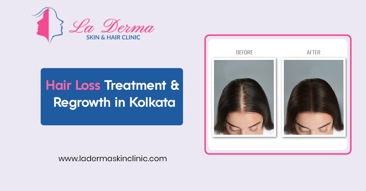 Hair Loss Treatment & Regrowth in Kolkata