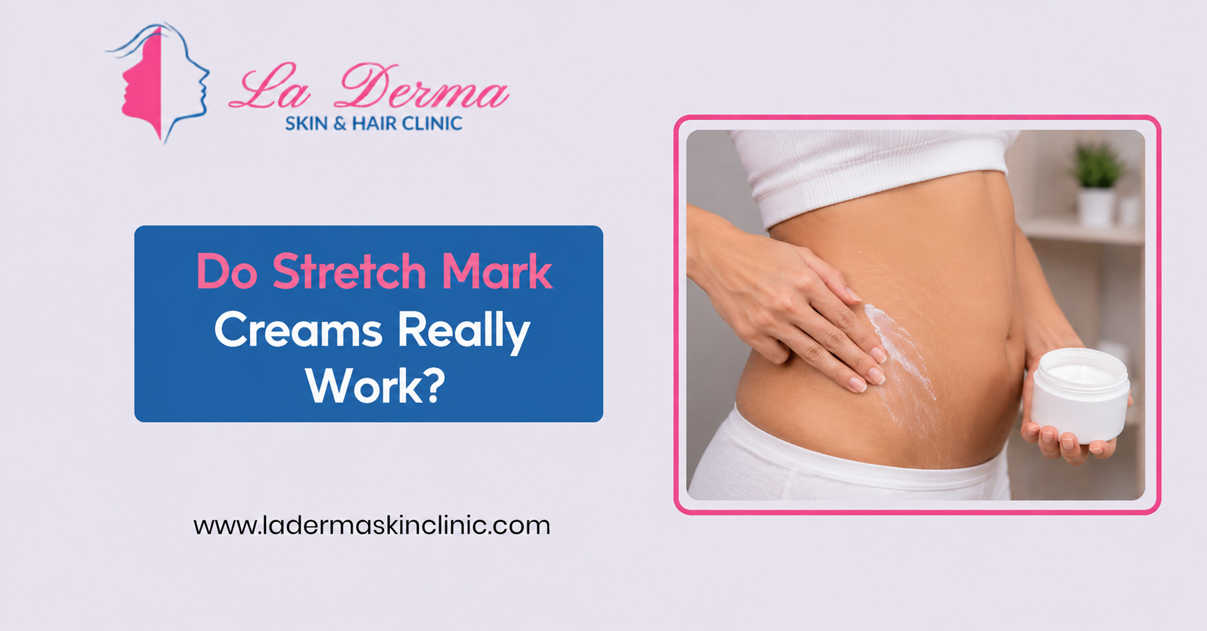 Do Stretch Mark Creams Really Work?