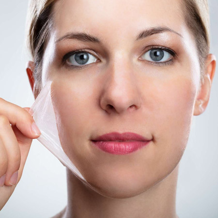  Overview of Skin Lightening Peel Treatment