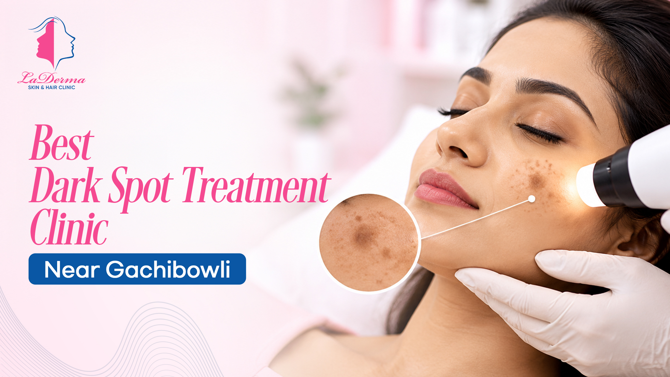 Best Dark Spot Treatment Clinic in Gachibowli – La Derma Skin & Hair Clinic