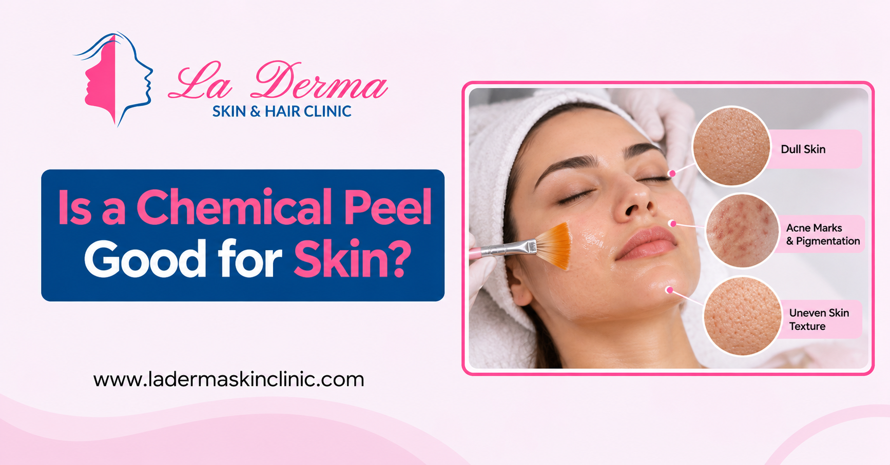 Is a Chemical Peel Good for Skin?