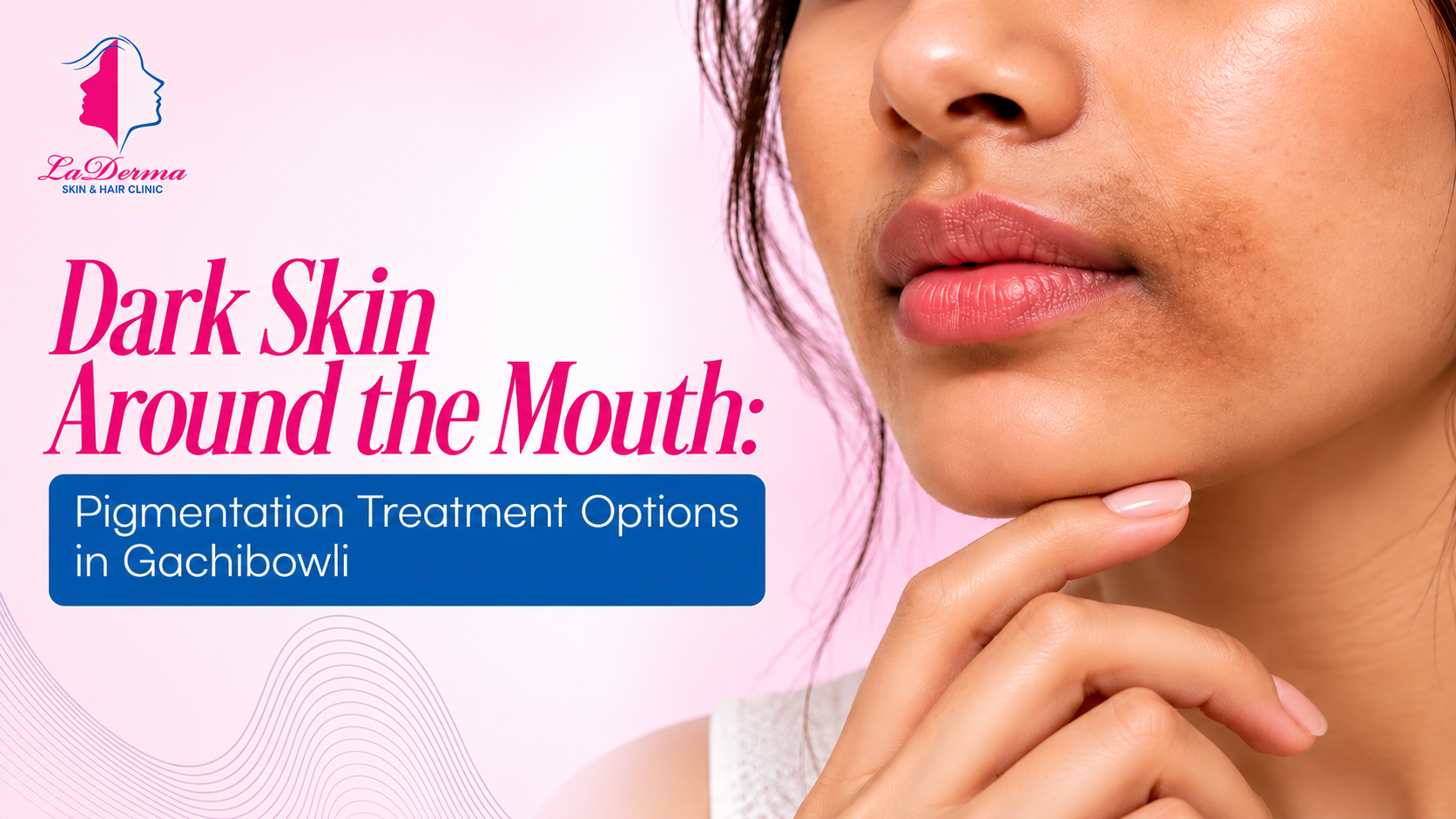 Dark Skin Around the Mouth: Pigmentation Treatment Options in Gachibowli