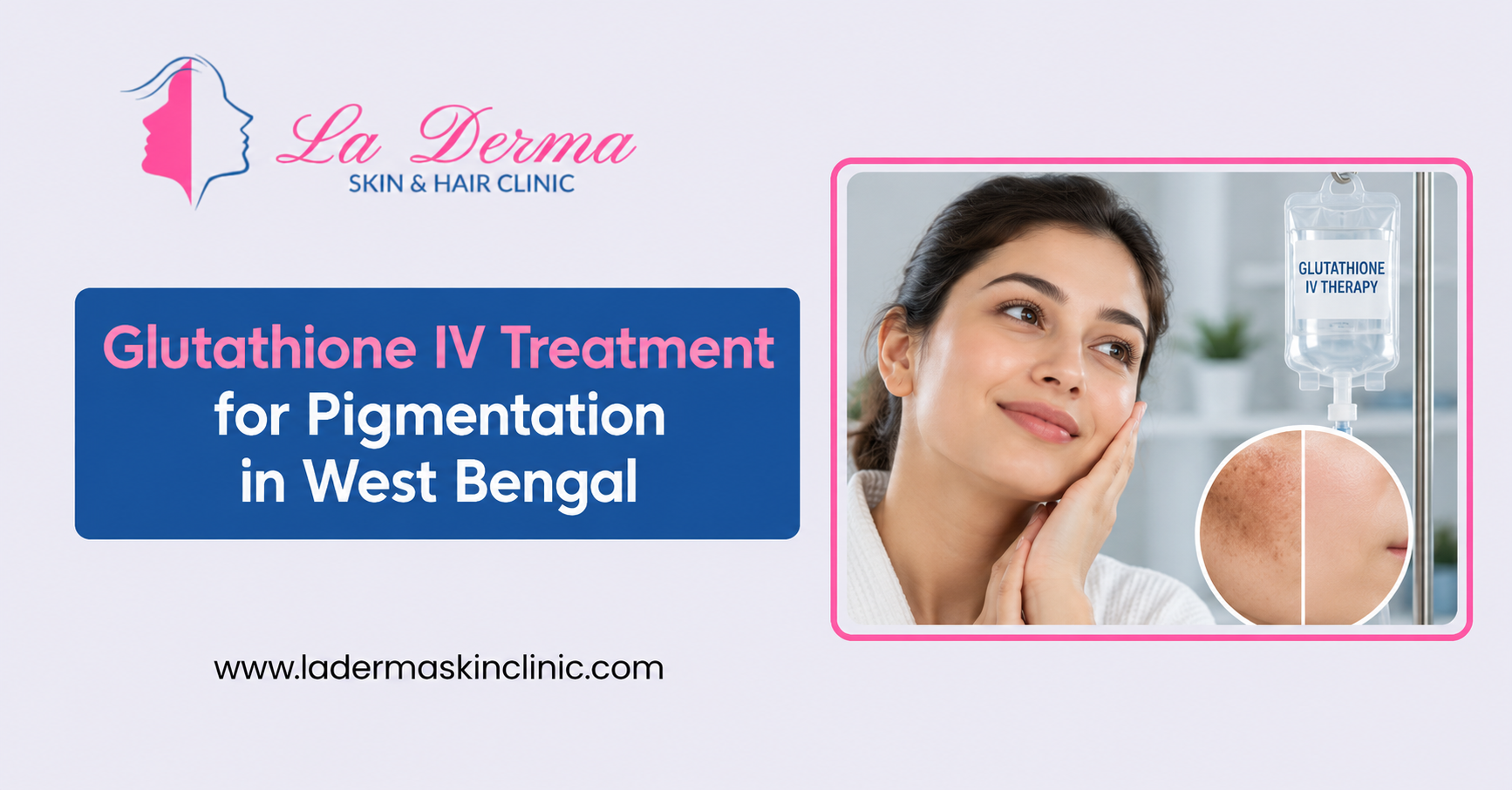 Glutathione IV Treatment for Pigmentation in West Bengal