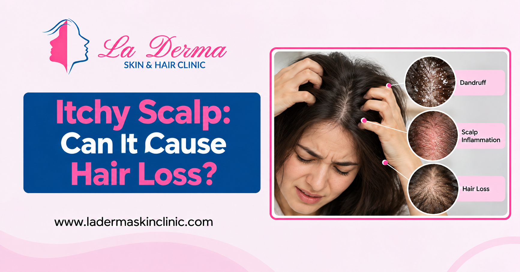 Itchy Scalp: Can It Cause Hair Loss?