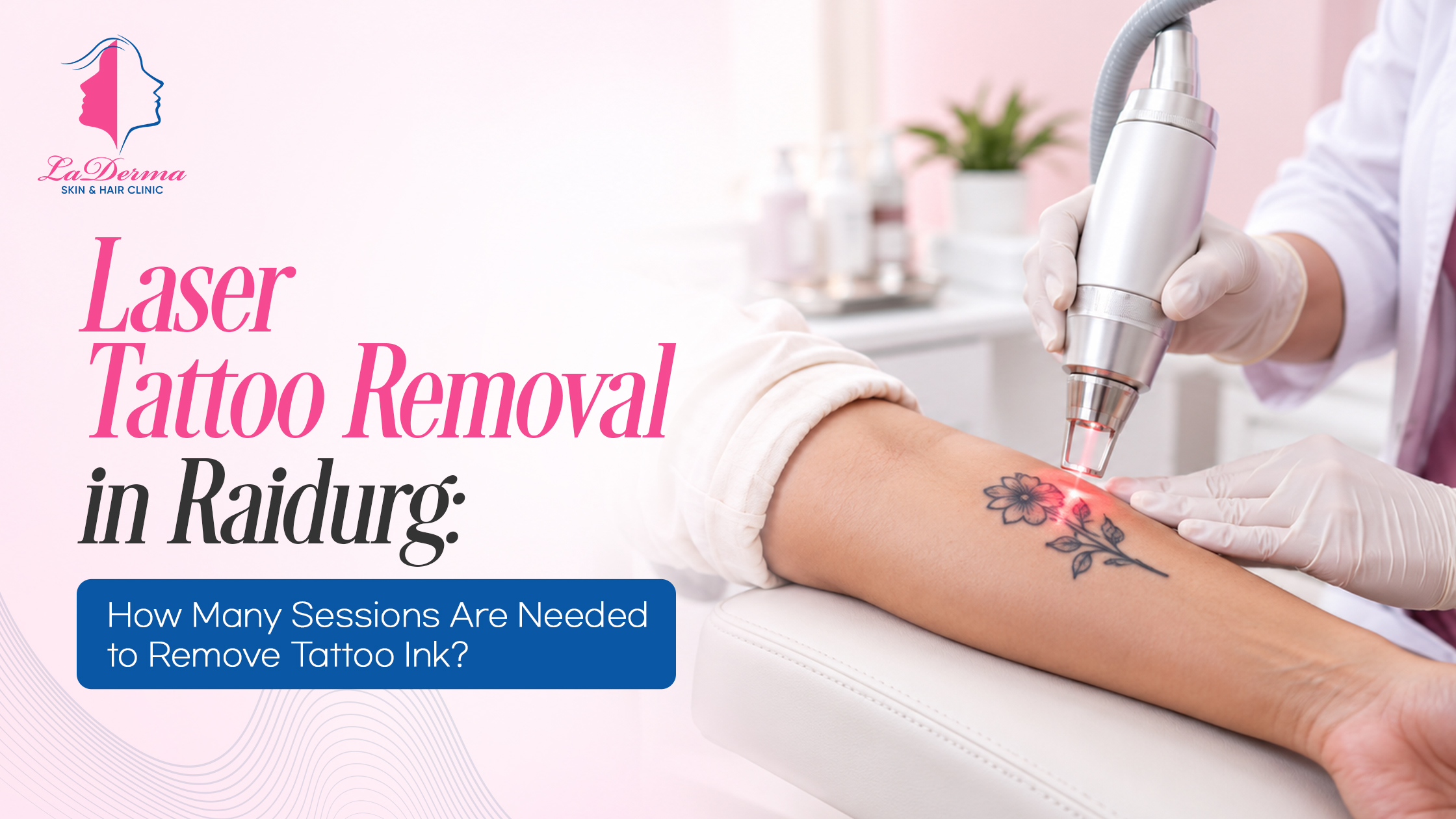 Laser Tattoo Removal in Raidurg: How Many Sessions Are Needed to Remove Tattoo Ink?