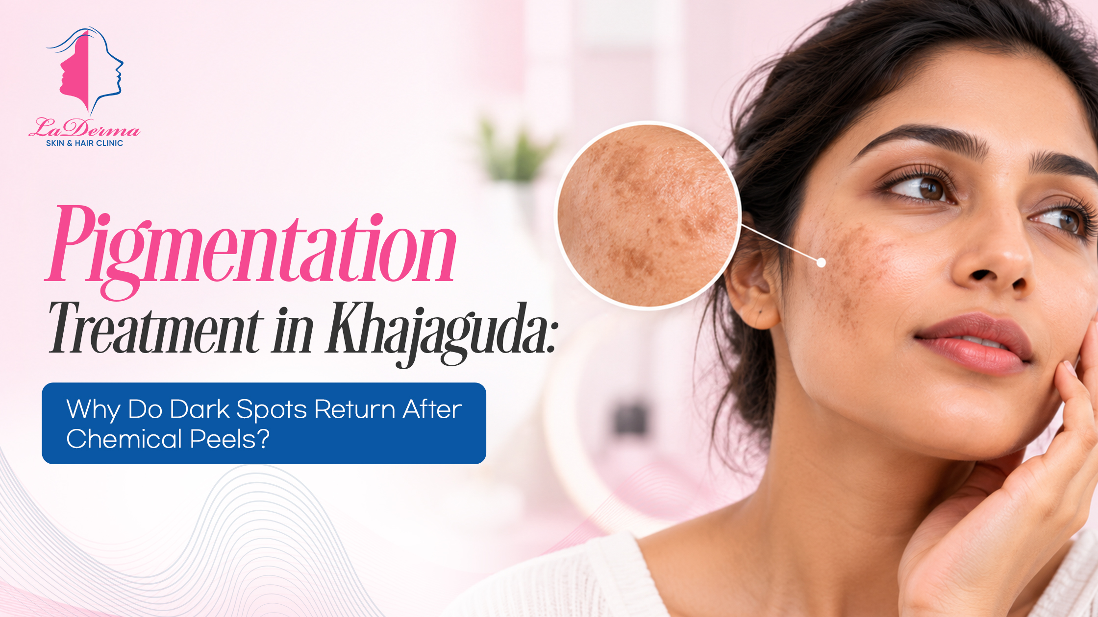 Pigmentation Treatment in Khajaguda: Why Do Dark Spots Return After Chemical Peels?