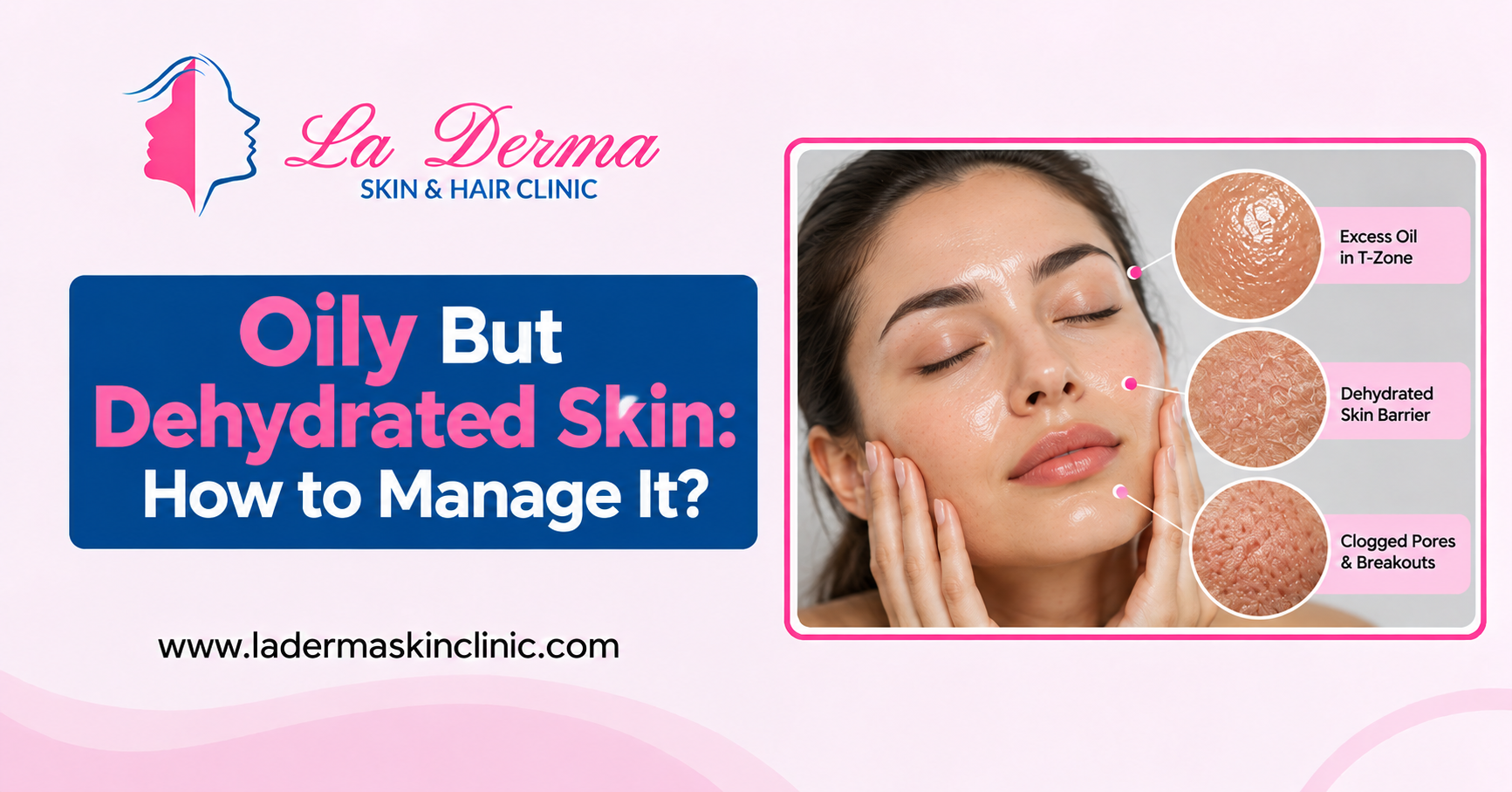 Oily But Dehydrated Skin: How to Manage It