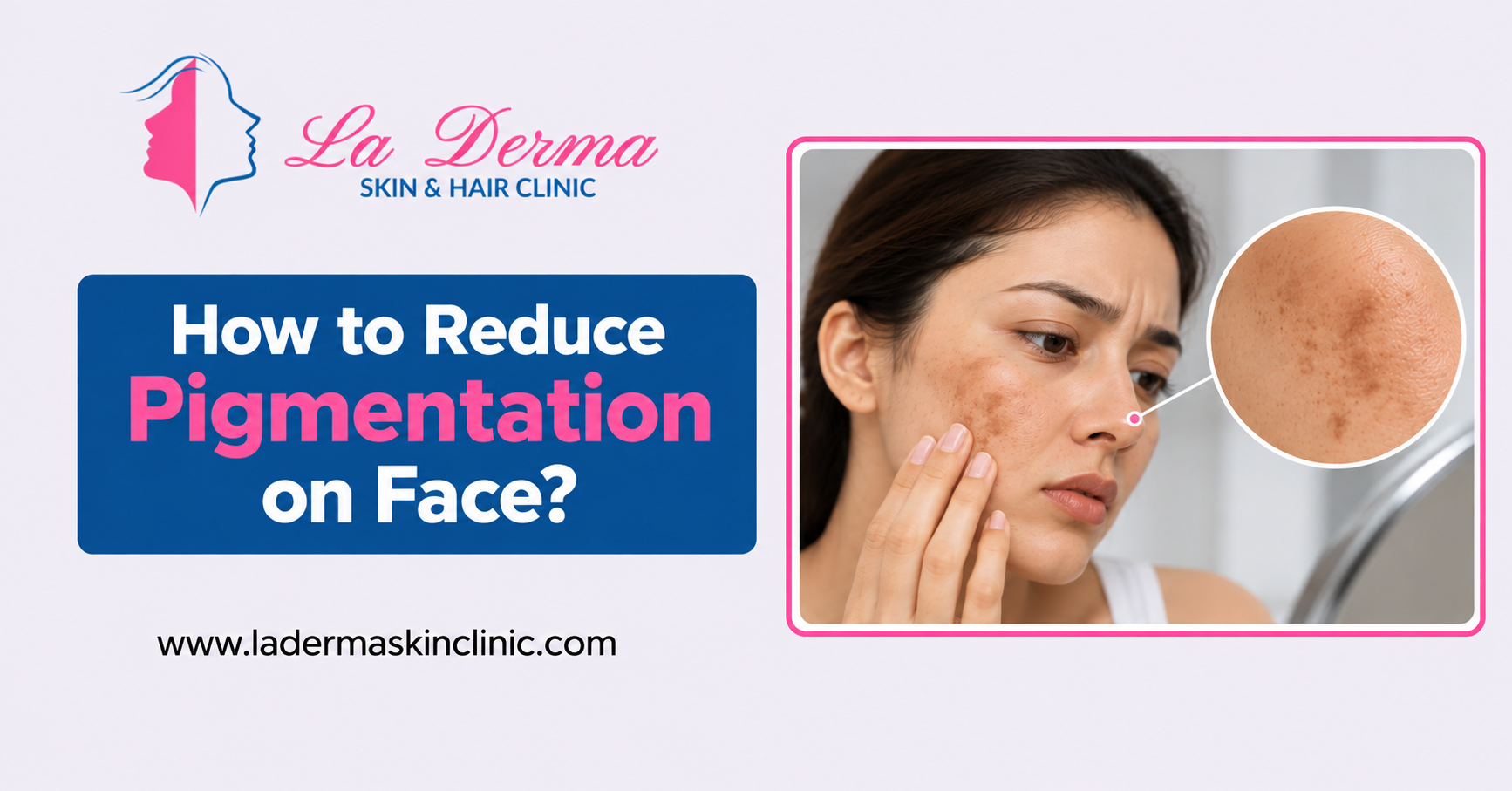 How to Reduce Pigmentation on Face