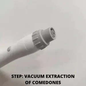 Vacuum extraction of comedones