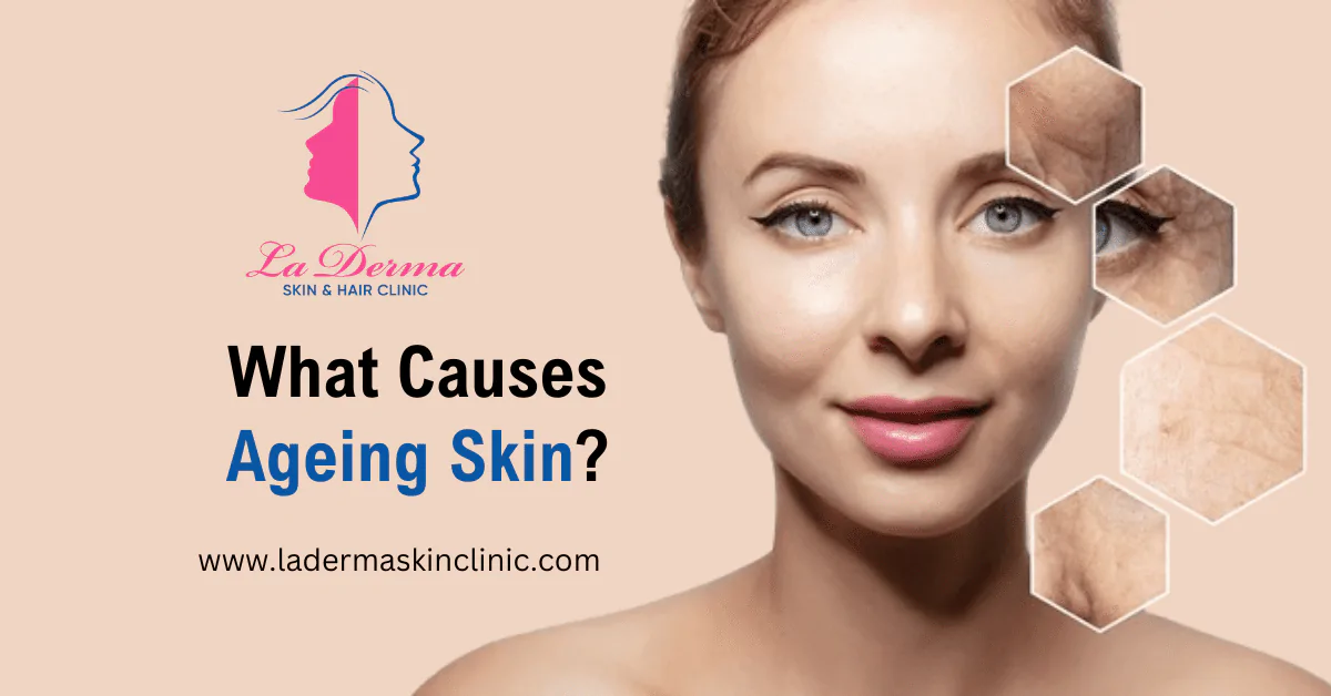 What Causes Ageing Skin & How to Prevent It?