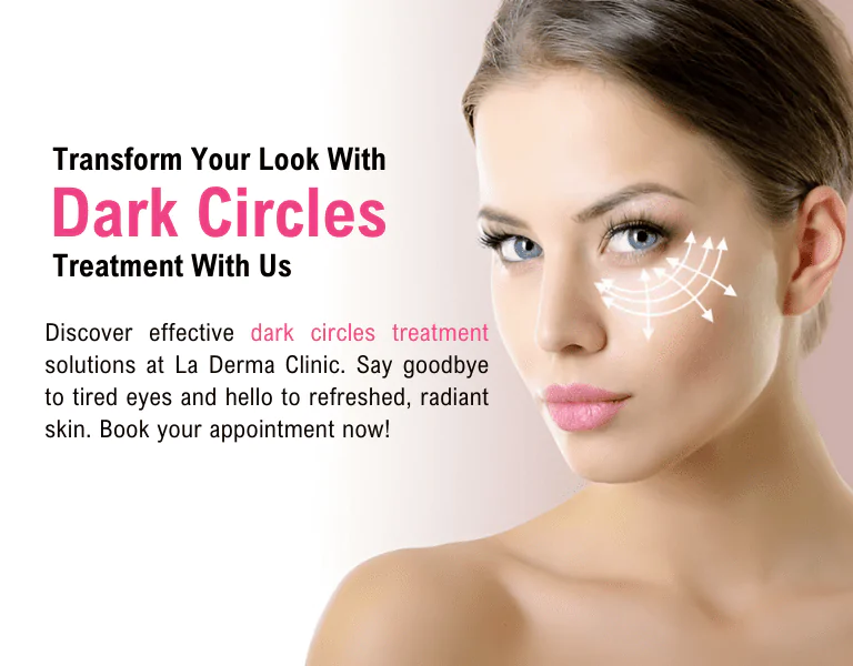 Dark Circles Removal Treatment