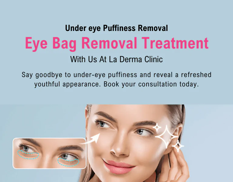 Under eye Puffiness Removal Treatment