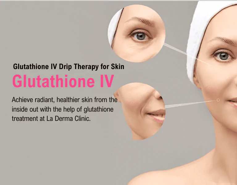 Glutathione IV Drip Therapy for Skin