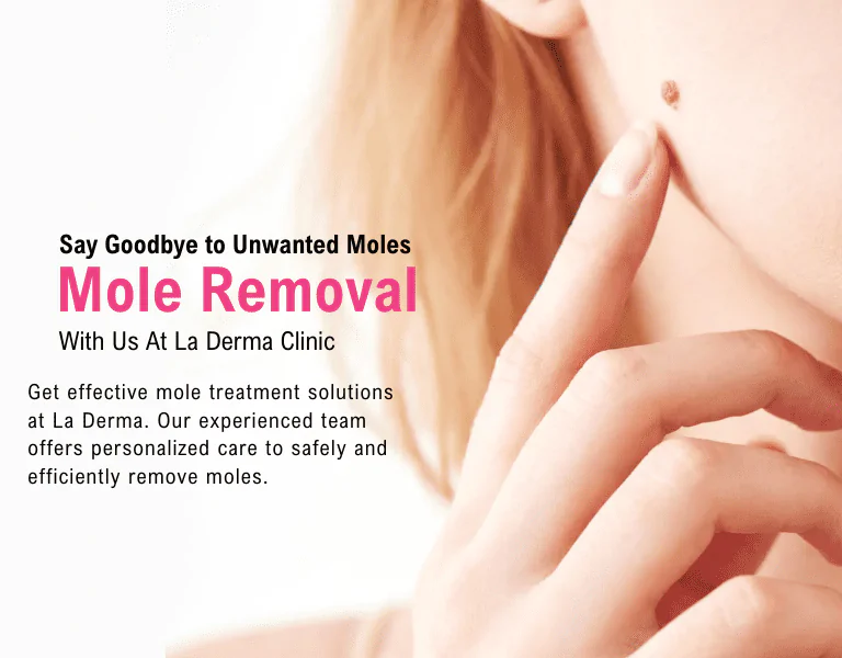 Mole, Skin Tags & Warts Removal Treatment