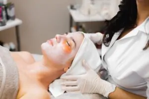 Chemical Peel