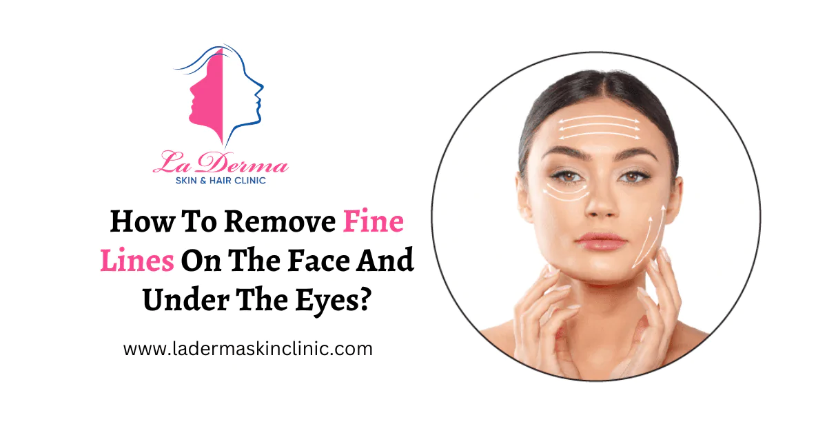 How To Remove Fine Lines On The Face And Under The Eyes?