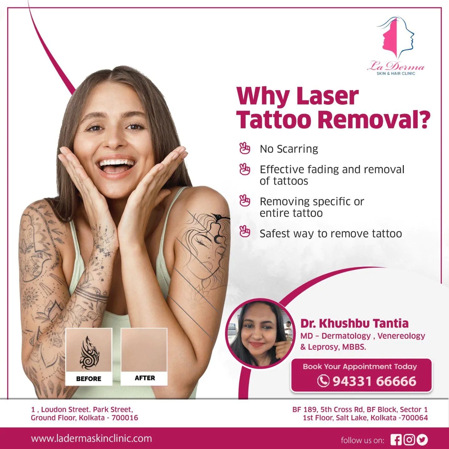 Why Laser Tattoo Removal at La Derma?