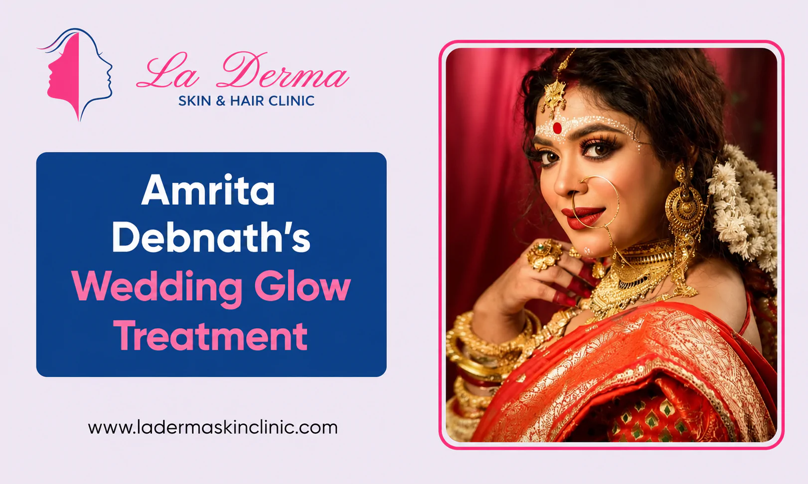 Amrita Debnath’s Wedding Glow Treatment: Glutathione Drip & Carbon Q-Switch at La Derma